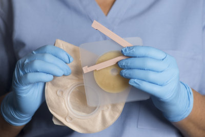 Nurse holds ostomy bag with adhesive wafer and bag clip